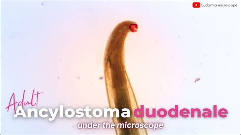 Adult Ancylostoma Duodenale Under The Microscope Youtube