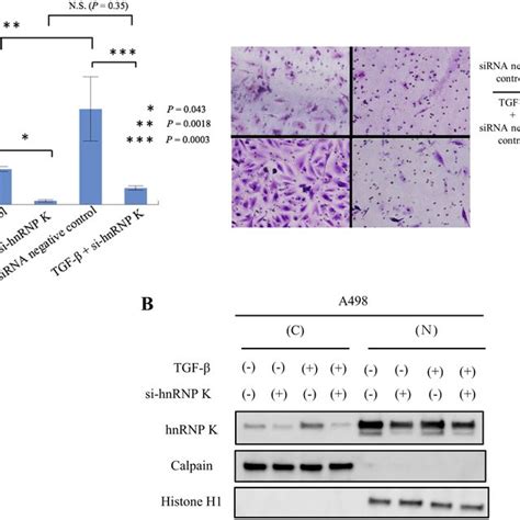 Knock Down Of Hnrnp K Strongly Suppresses Tgf Induced Rcc Cell