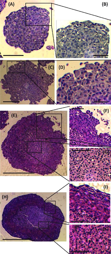 Haematoxylin And Eosin Staining Of Spheroid Sections Images Of