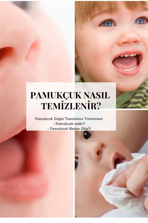 Pamukçuk Nasıl Temizlenir Bebek Tıbbi Bağışıklık sistemi