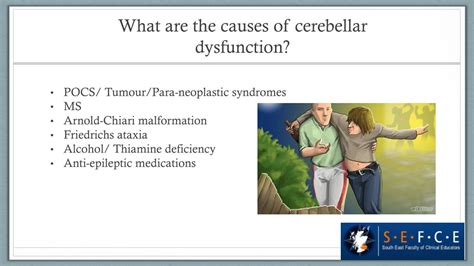 PPT - Neurology - cerebellar PowerPoint Presentation, free download ...