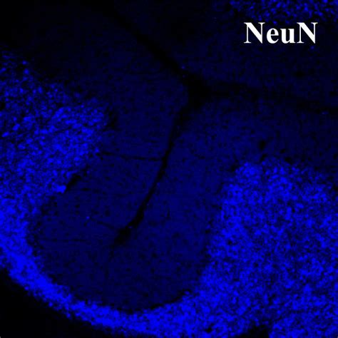 Map Of P2Y1 Receptor Protein In Juvenile Rat Cerebellar Cortex Sagital