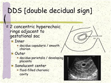 Ppt Normal First Trimester Powerpoint Presentation Free Download