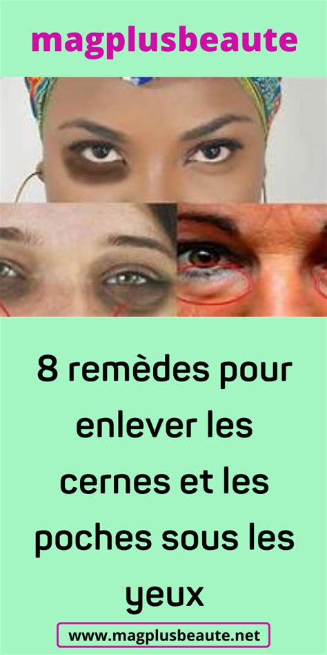 Une Astuce Naturelle Pour Enlever Les Cernes Sous Les Yeux Artofit