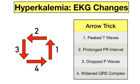 Hyperkalemia Ecg Changes Mnemonic With Ecg Strips | The Best Porn Website