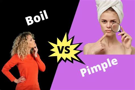 Boil Vs Pimple | ContrastHub