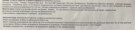 Урсофальк отзывы - Печень - Первый независимый сайт отзывов Украины