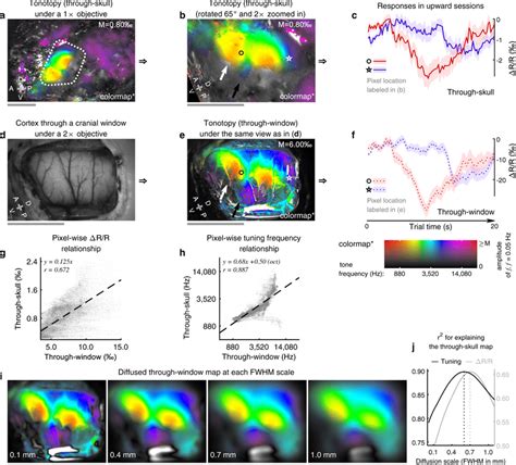 Comparison Of Tonotopic Maps Acquired Through Skull Or Without The