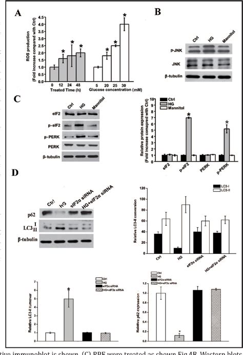 Figure 1 From Regulation Of Autophagy By High Glucose In Human Retinal