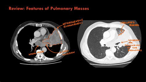 Radiology Quiz 138345 Radiopaedia Org Playlist Year 2