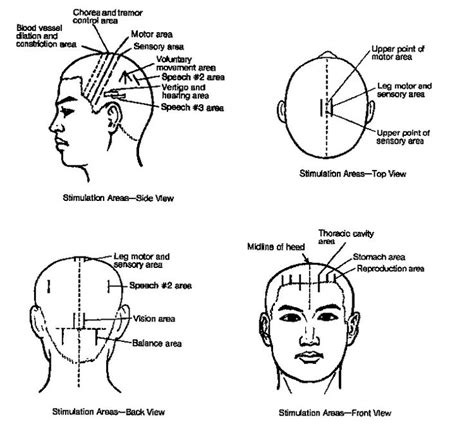 Scalp Acupuncture Acupuncture Acupuncture Points Acupressure