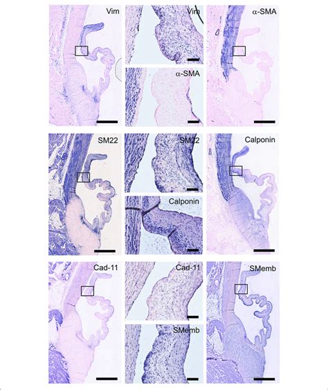 Valvular Interstitial Cell Vic Markers Tile Scans Of Sheep Aortic