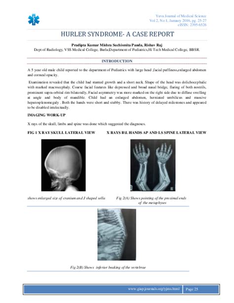 Pdf Hurler Syndrome A Case Report Mges Journals