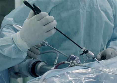 Laparoscopic Gynecology Surgery |Major Surgeries