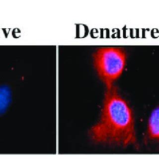 Effect Of Denatured Type I Collagen On Smooth Muscle Cell Morphology