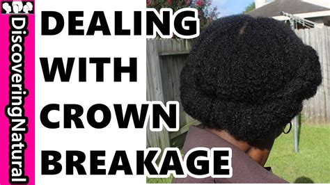 Dealing With Breakage In Crown Of Hair And Crown Thinning YouTube