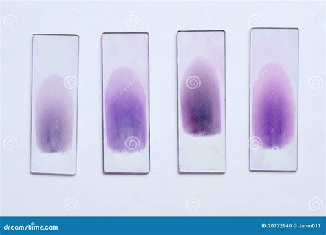 Blood Smear Stain Stock Images - Download 440 Royalty Free Photos - Page 2