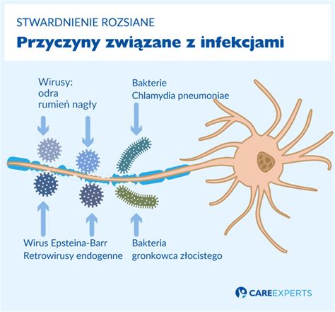 Przyczyny Stwardnienia Rozsianego Care Experts