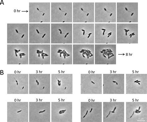 Time Lapse Microscopy Of C Crescentus Cells Shifted From Nutrient Poor