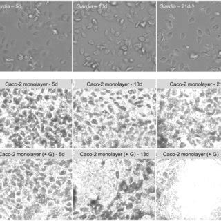 Caco 2 Cells Were Grown To Confluence In 96 Well Plates And Cultured