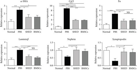 Effects of MSCs on α SMA Col I FN laminin β nephrin and