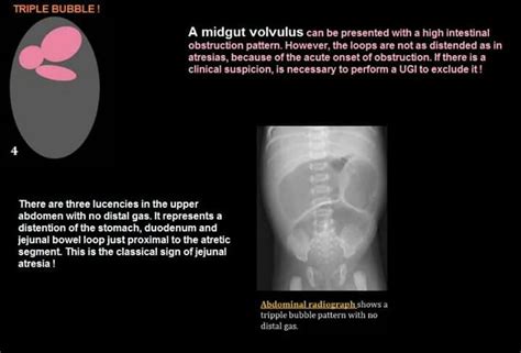 Pin By Aleksandra Stawik On Medyczne Radiology Imaging Pediatrics