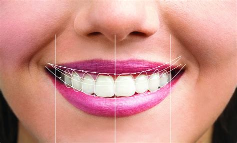 5 Ways Dental Smile Design Can Transform Your Look