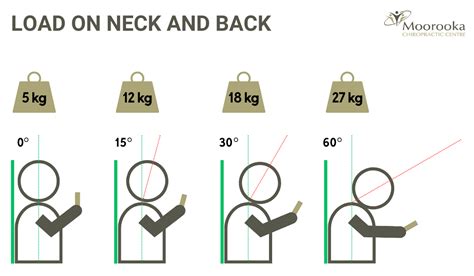 Forward Head Posture