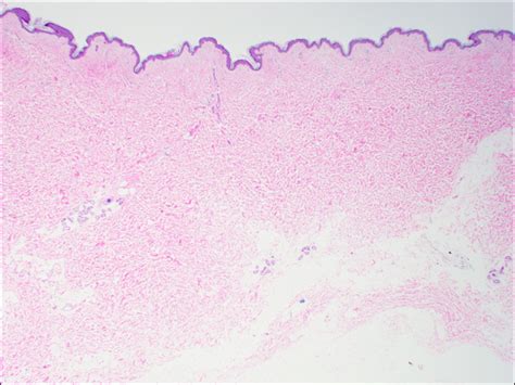 Skin – Normal Histology – NUS Pathweb :: NUS Pathweb