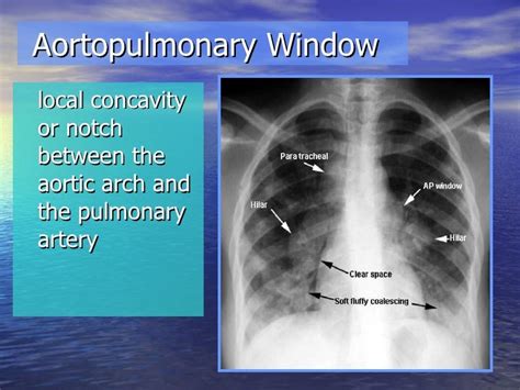 Basic Radiology