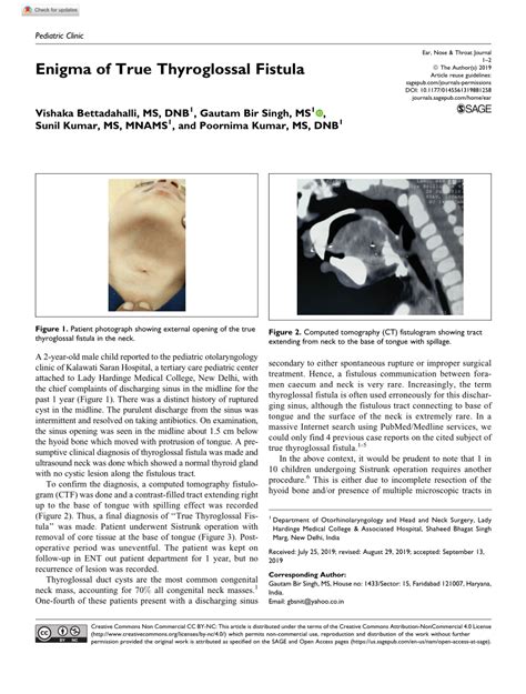 Pdf Enigma Of True Thyroglossal Fistula