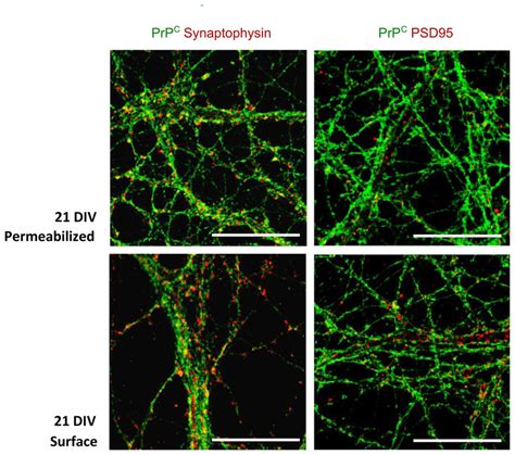 Prp C Co Immunolabeling With Synaptophysin Left And Psd Right