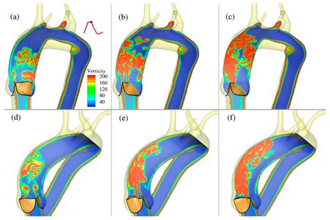 Image Guided Fluid Structure Interaction Simulation Of Transvalvular