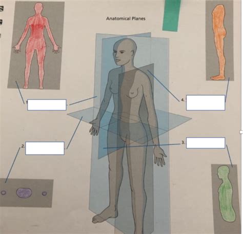 Anatomical Planes Flashcards Quizlet