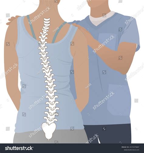 Anatomy Curvature Spine Scoliosis Posture Correction Stock Vector