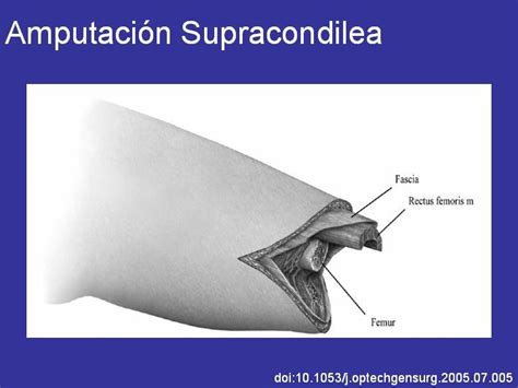 Presentaciones - Depto. Cirugía Hospital del Salvador