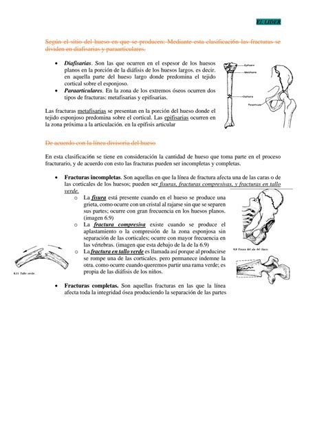 Solution Clasificacion De Las Fracturas Studypool