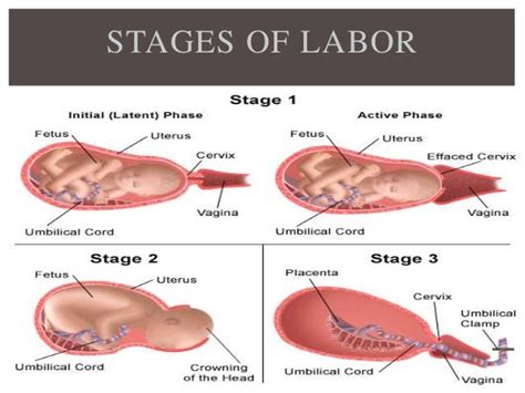 First Stage Of Labour And Midwifery Care