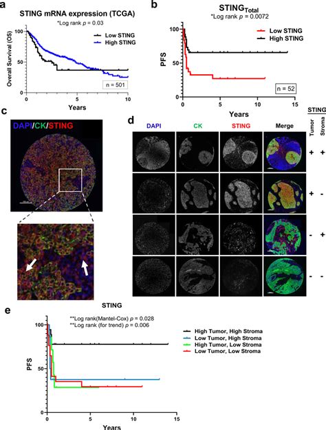 Sting Expression And Outcomes In Hnscc A Kaplanmeier Curves Of Hnscc