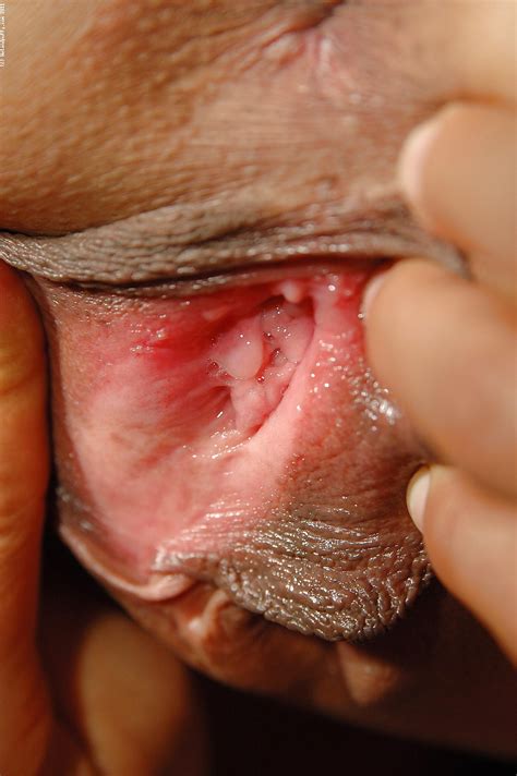 Vagina Of All Types Porn Pictures XXX Photos Sex Images PICTOA