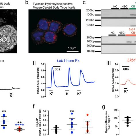 Conditional Deletion Of Lkb1 In Tyrosine Hydroxylase Expressing Cells