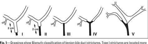 Figure 1 From Benign Biliary Strictures A Current Comprehensive