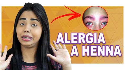 COMO FAZER O TESTE DE ALERGIA A HENNA Por Que Fazer YouTube