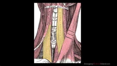 007 – Cricothyroidotomy | Anatomy For Emergency Medicine