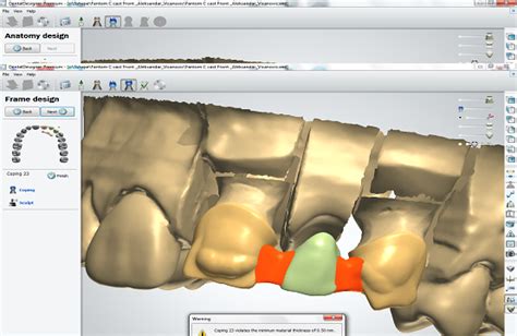 CAD CAM STOMATOLOGIJA Najsavremenija Tehnologija