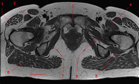 MRI Of The Hip Detailed Anatomy