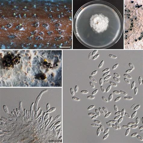 Diaporthe Citri Ex Epitype Culture Ar3405 Cbs 135422 A Download Scientific Diagram