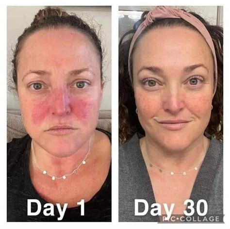 Before And After The Best Collagen Elixir