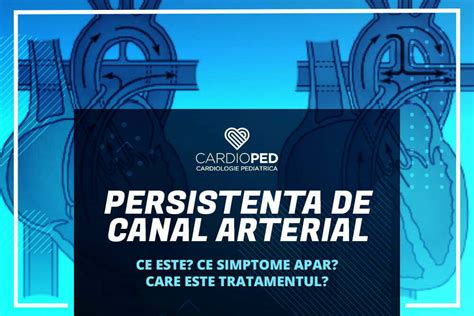 Persistenta De Canal Arterial Pca Cardioped Ro