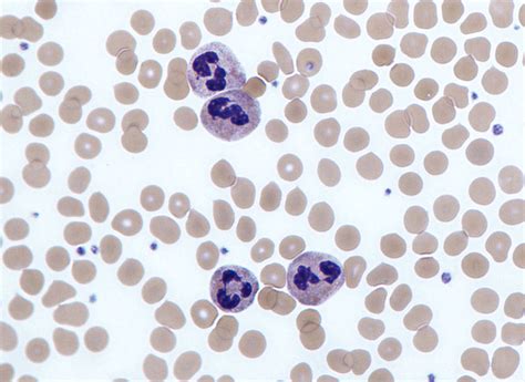 Neutrophil Wikipedia